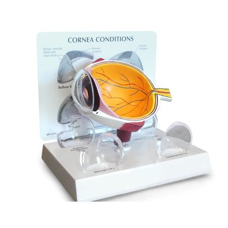 GPI ANATOMICAL Anatomical Model - Cornea Eye 2780